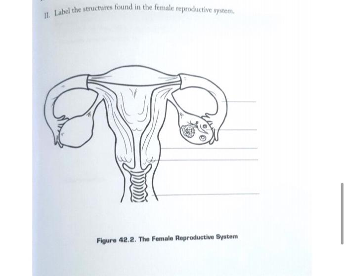 Solved I Label the structures found in the male reproductive | Chegg.com