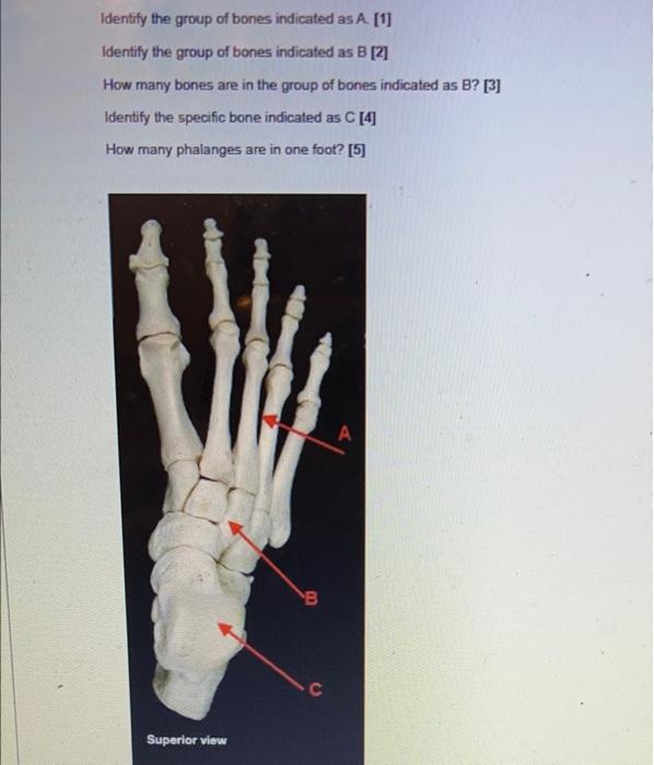 Solved Identify the group of bones indicated as A. [1] | Chegg.com