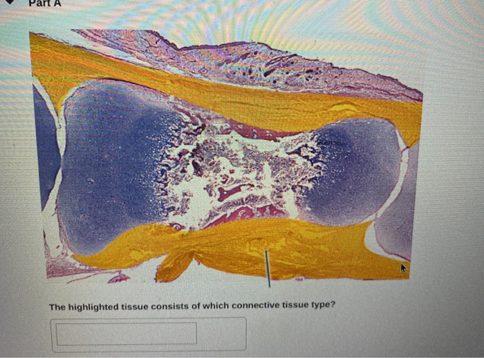 Solved Part A The highlighted tissue consists of which | Chegg.com