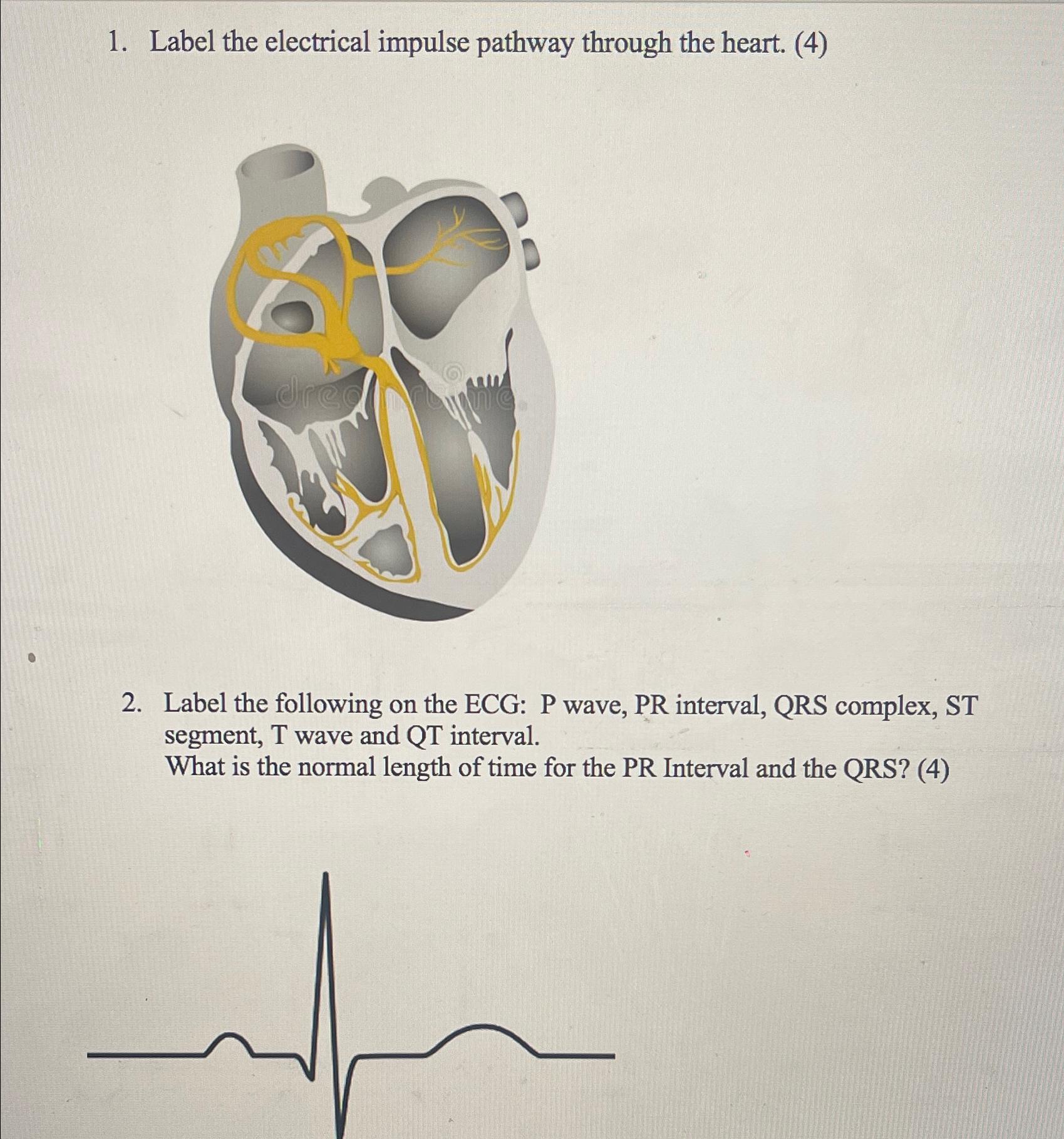 Solved Label the electrical impulse pathway through the | Chegg.com