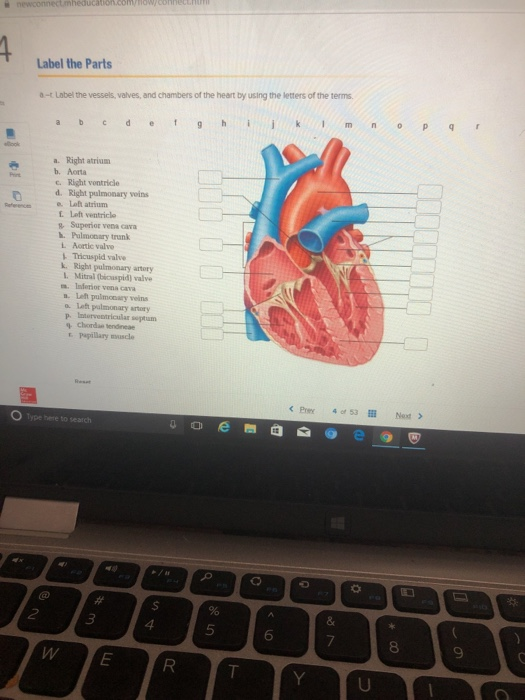 Solved Label the Parts Usbelthe vessels, valves and