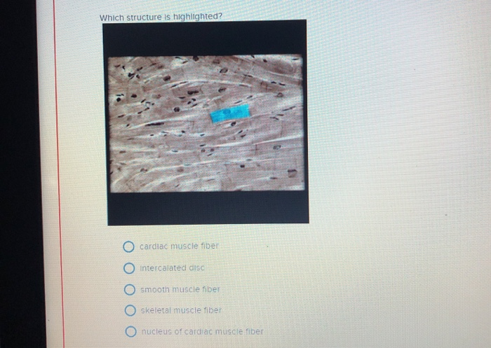 Which Structure Is Highlighted Branched Cardiac Muscle Fiber