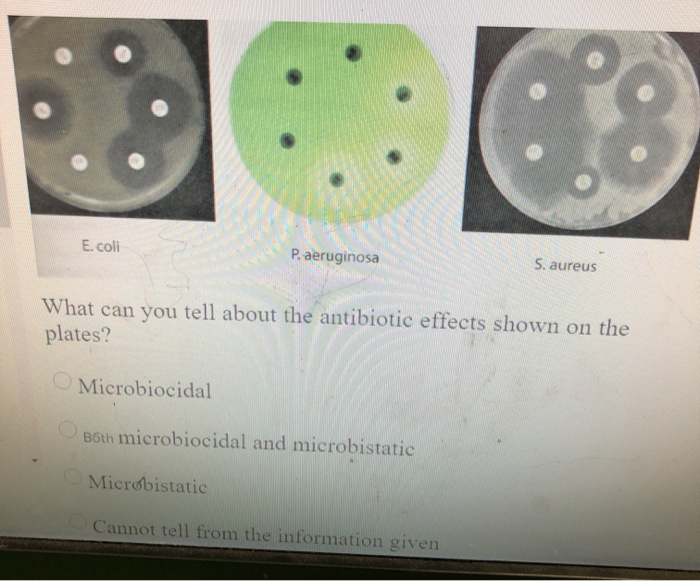 Solved E.coli P. aeruginosa S. aureus What can you tell | Chegg.com