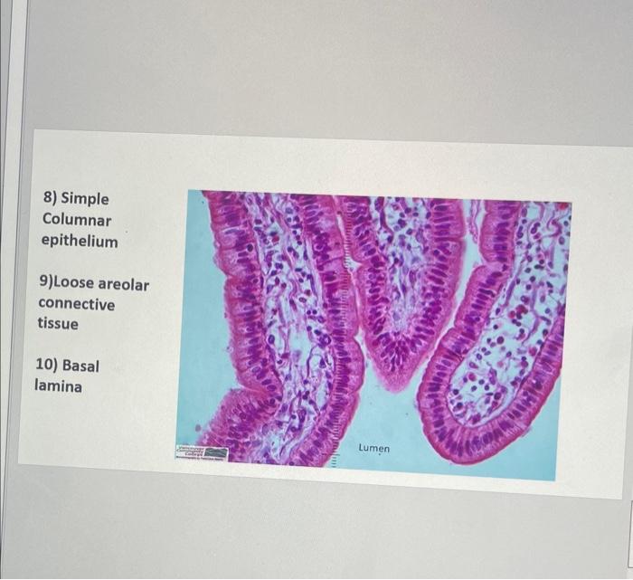 Solved 8) Simple Columnar epithelium 9)Loose areolar | Chegg.com