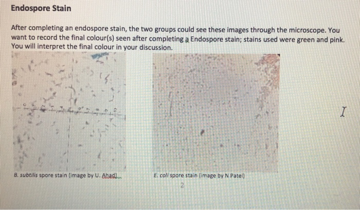 Solved Endospore Stain After completing an endospore stain, | Chegg.com