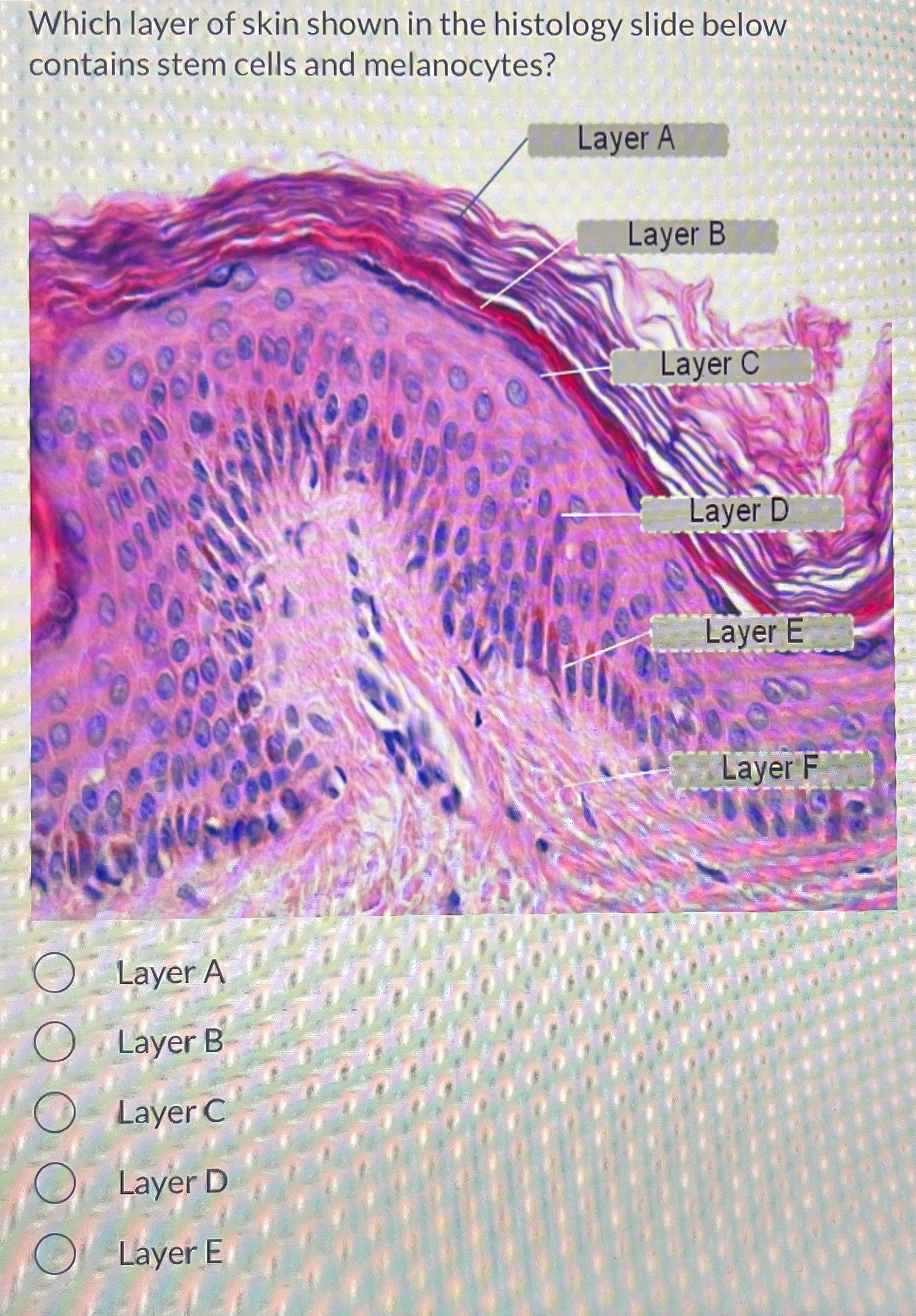 Solved Which layer of skin shown in the histology slide | Chegg.com