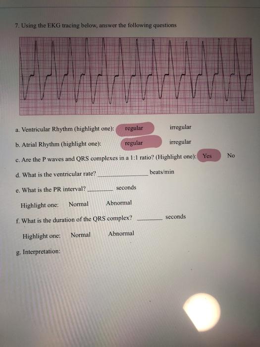 Options For Interpretations Are Sinus Rhythm Sinus Chegg Com