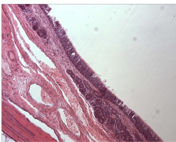 Solved + 1. General Tissue Type: EPITHELIAL Specific Tissue | Chegg.com