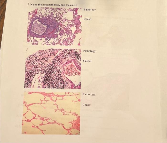 Solved 7. Name the lung pathology and the cause. Pathology: | Chegg.com