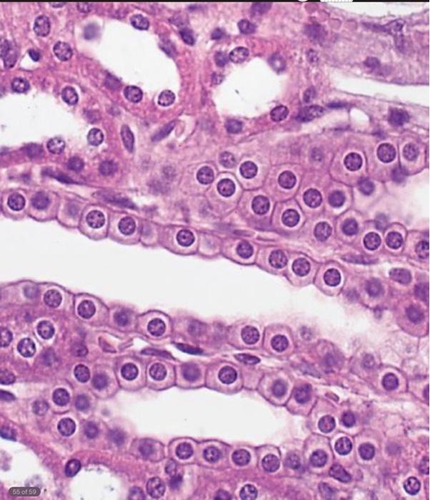 Solved what kind of epithelial tissue? | Chegg.com