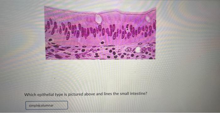 Solved Which epithelial type is pictured above and lines the | Chegg.com