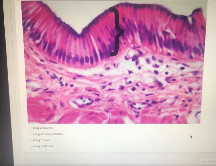 Solved lining of bronchi lining of urinary bladder lining of | Chegg.com