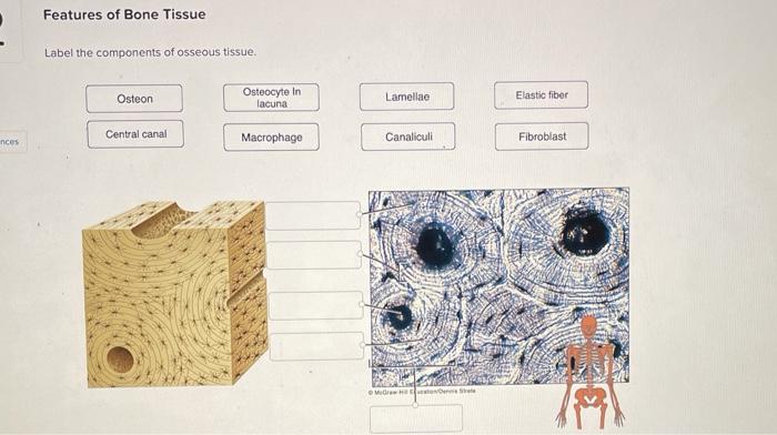 bone tissue labeled