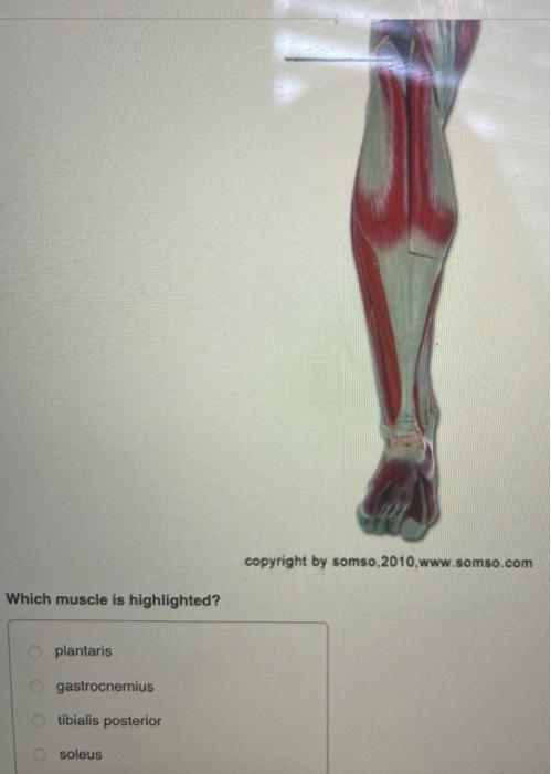 Solved Which muscle is highlighted? fibularis longus | Chegg.com