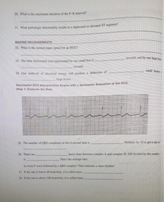 20. What is the maximum duration of the Peral? 21. What pathologie shromality results is a depressed or elevated ST wegment?