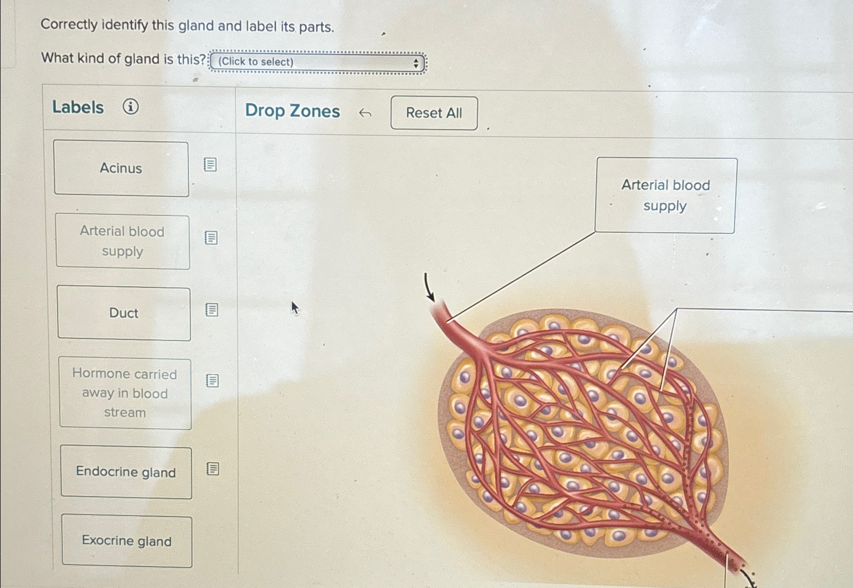 solved-correctly-identify-this-gland-and-label-its-chegg