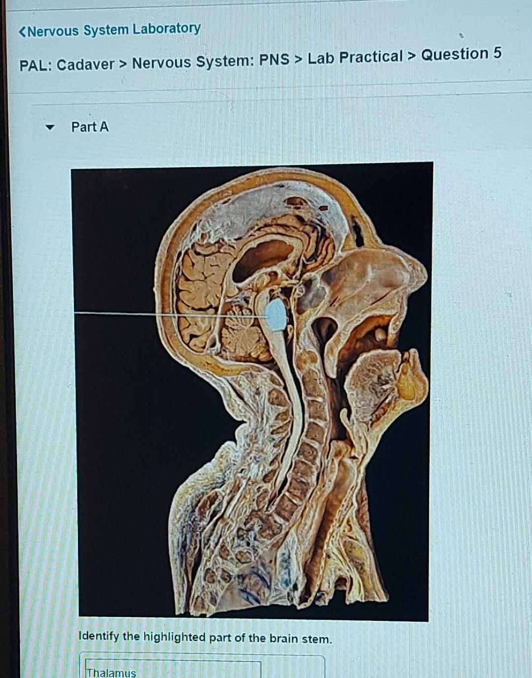 Solved Nervous System: PNS > Lab Practical > Question 5 | Chegg.com