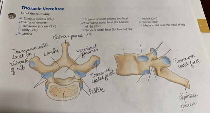 Illustration of thoracic vertebrae showing vertebral body, pedicles