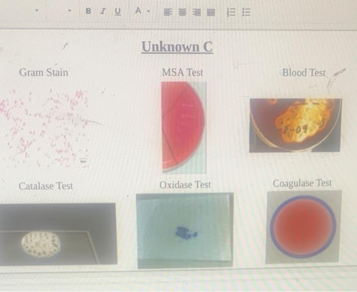 Solved 12 steps for Identification of Unknown "Bacteria" Lab