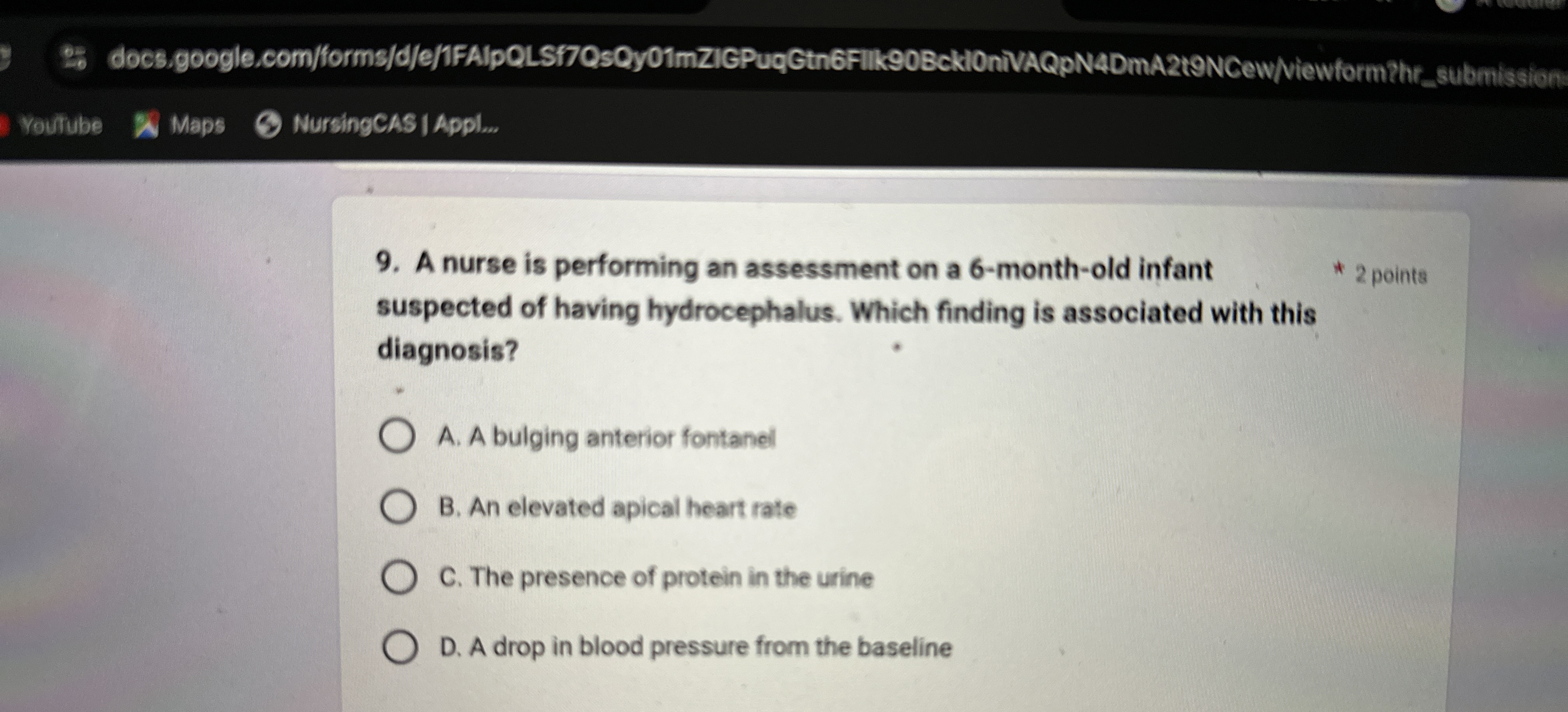 Solved A nurse is performing an assessment on a 6 monthold