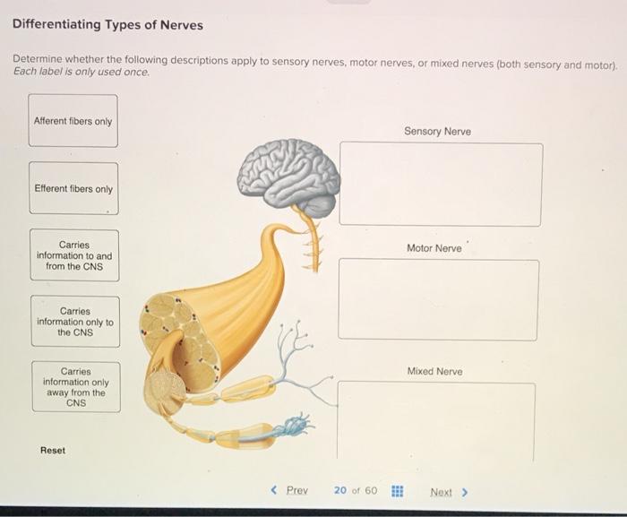 Solved Differentiating Types of Nerves Determine whether the