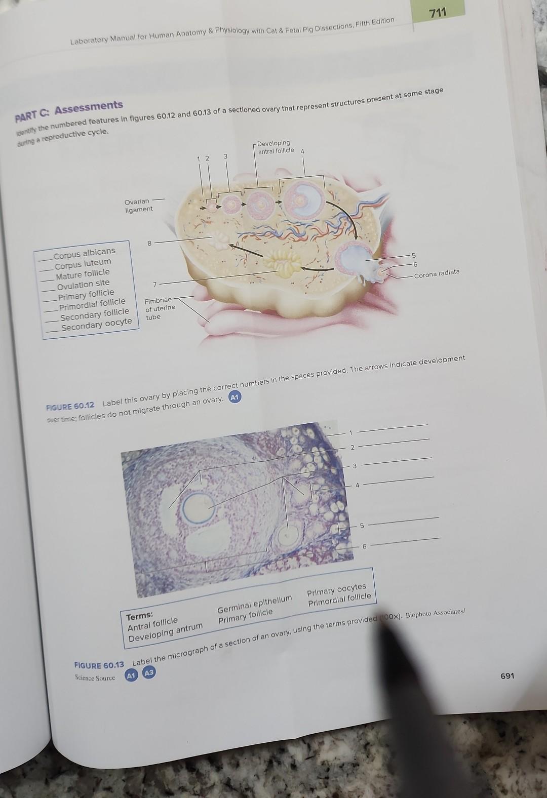 Solved Laboratory Manual for Human Anatomy \& Physiology