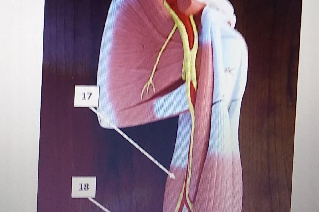 Solved 12. The runs through the bicipital groove. A.