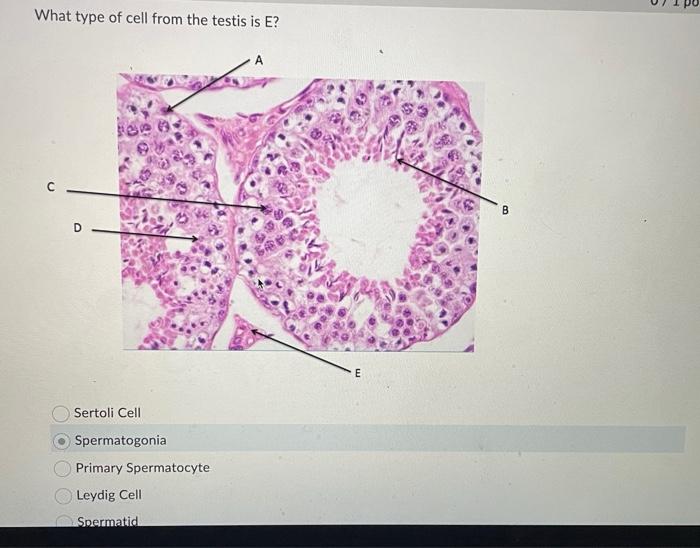 Solved What type of cell from the testis is E? Sertoli Cell | Chegg.com