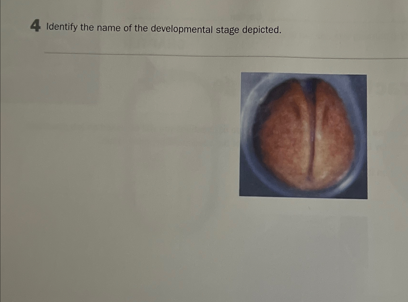 Solved Identify the name of the developmental stage | Chegg.com