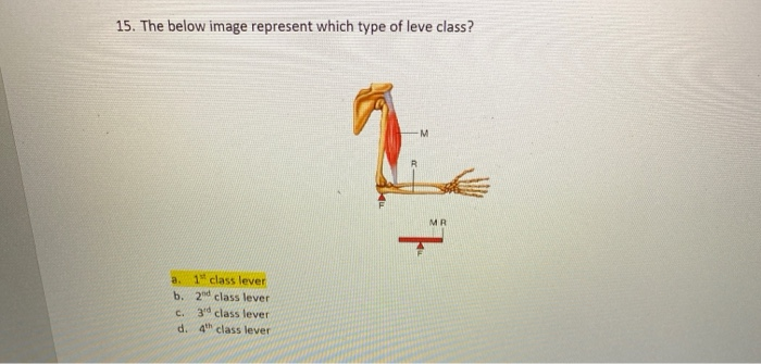 Solved 15. The below image represent which type of leve | Chegg.com
