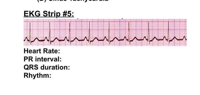 Solved Ekg Strip \#5: Heart Rate: Pr Interval: Qrs Duration: 