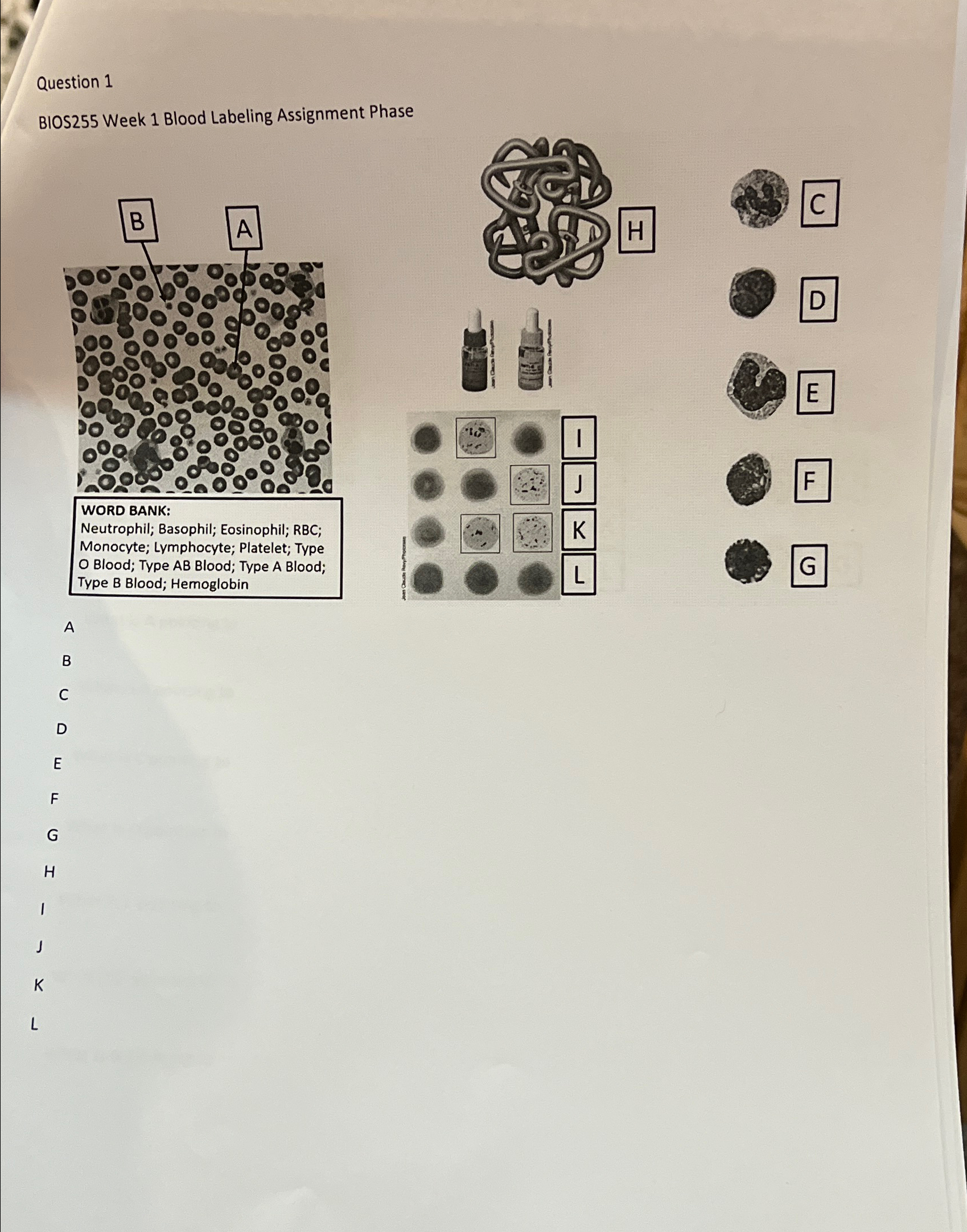 Solved Question 1BIOS255 ﻿Week 1 ﻿Blood Labeling Assignment | Chegg.com