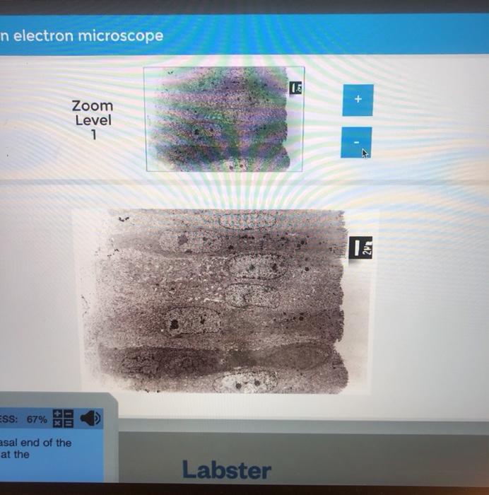 Solved Transmission electron microscope Zoom Level 1 10