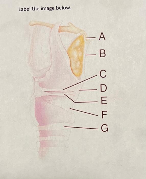 Solved Label the image below.