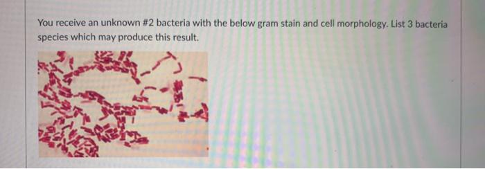 Solved You receive an unknown #2 bacteria with the below | Chegg.com