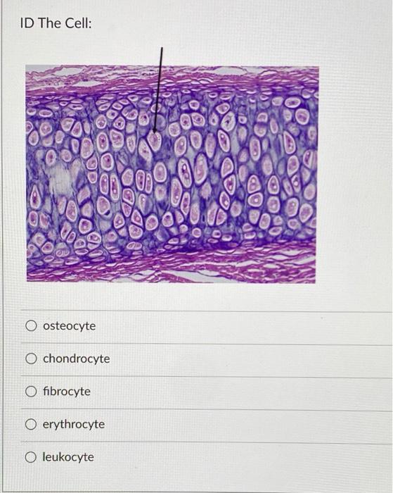 Solved ID The Cell: O osteocyte O chondrocyte O fibrocyte O | Chegg.com