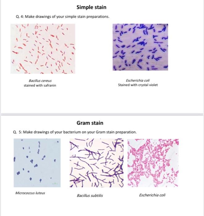 Simple stain vs gram deals stain