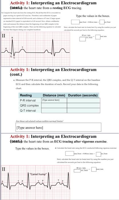 Activity 1: Interpreting an Electrocardiogram | Chegg.com