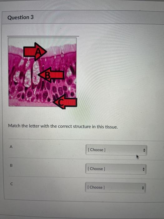 Solved Question 3 Match the letter with the correct | Chegg.com