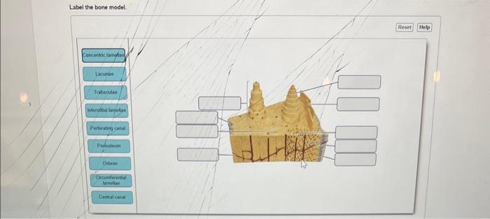 Label the bone model. | Chegg.com
