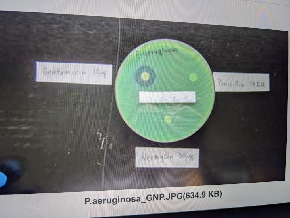 Disk Diffusion Results Diameter of Zone of Inhibition | Chegg.com