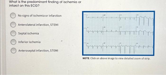 Solved What is the predominant finding of ischemia or | Chegg.com