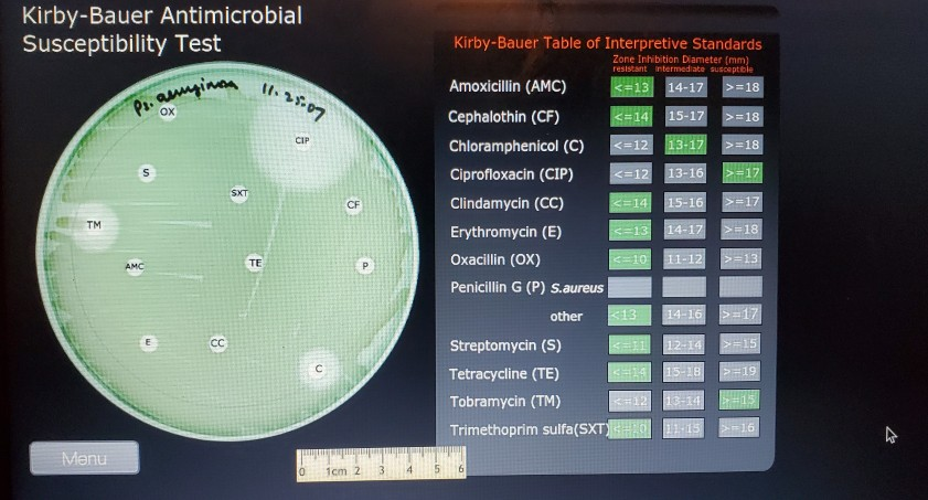 Solved Kirby-Bauer Antimicrobial Susceptibility Test 
