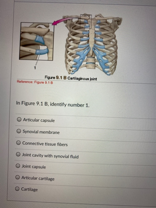 Solved Figure 9.1 B Cartilaginous joint Reference: Figure | Chegg.com