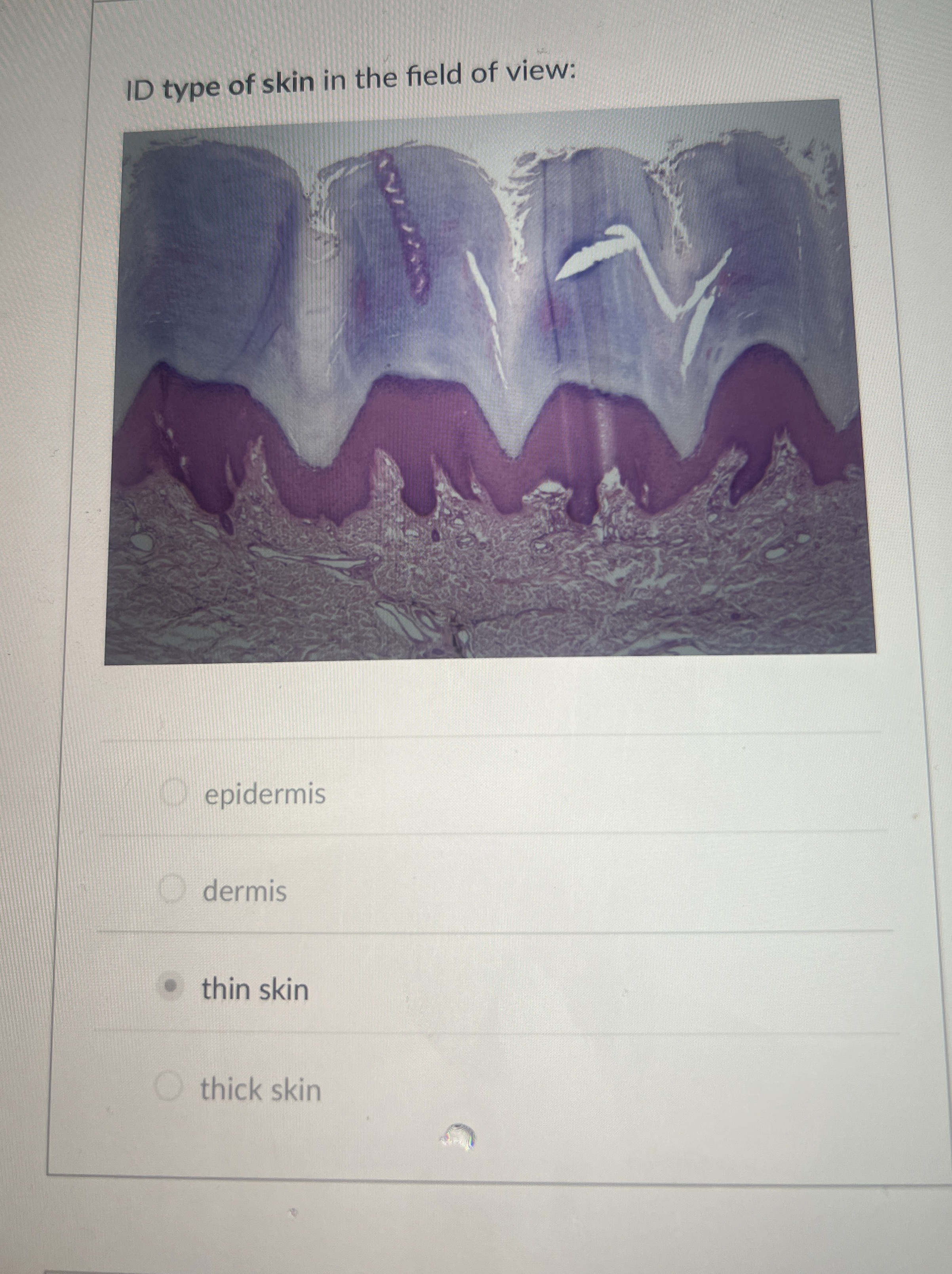 Solved ID type of skin in the field of | Chegg.com