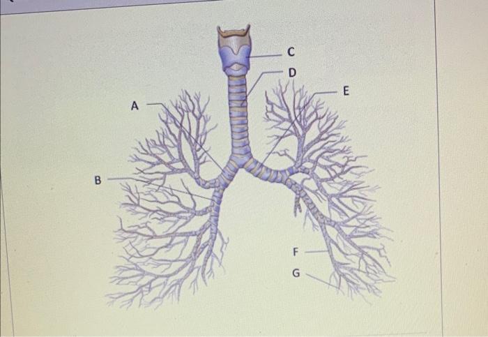 Solved [Choose] Tertiary (Segmental) bronchus Trachea | Chegg.com