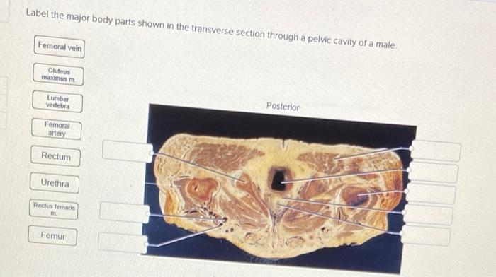 Solved Label the major body parts shown in the transverse | Chegg.com