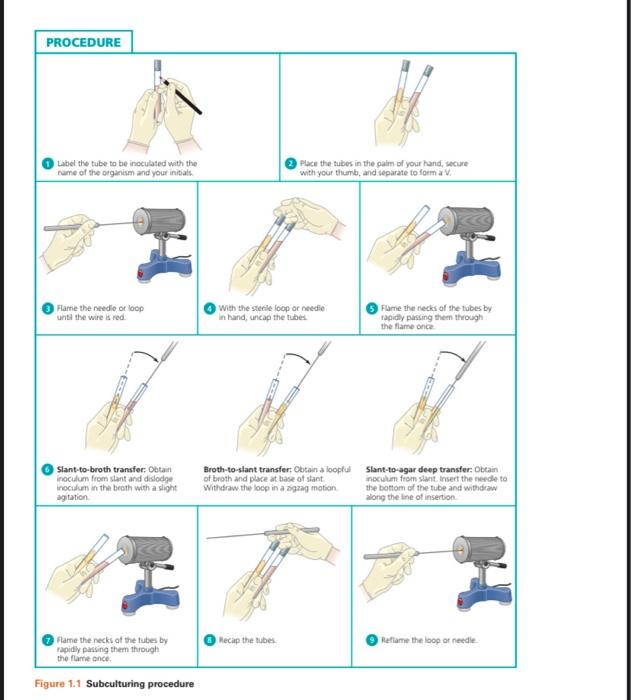 Solved PROCEDURE Label the tube to be inoculated with the | Chegg.com