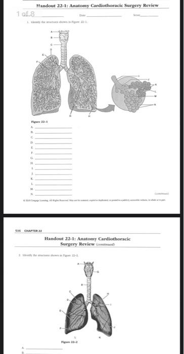 Solved Handout 22-1: Anatomy Cardiothoracic Surgery Review | Chegg.com