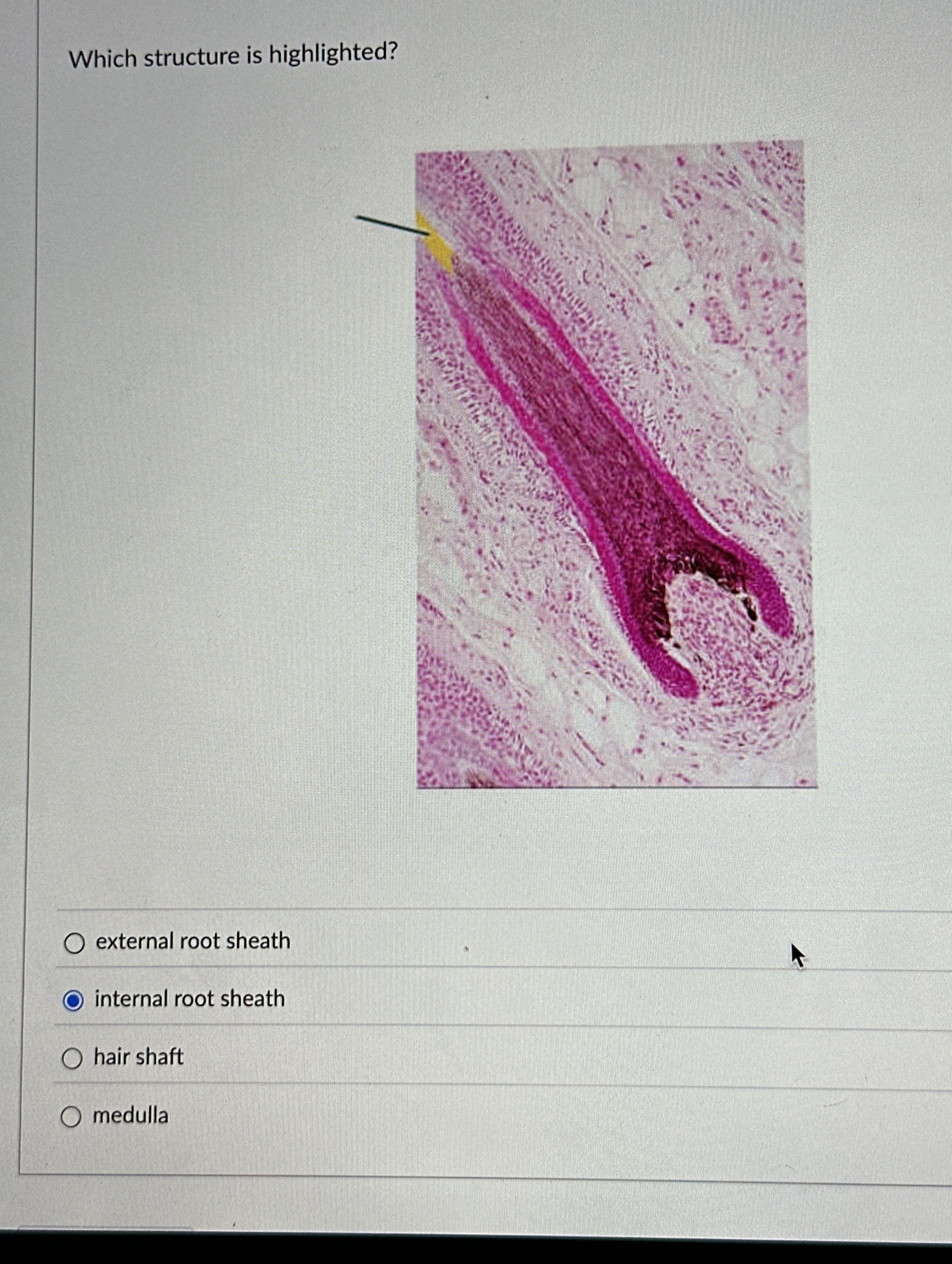 Solved Which structure is highlighted?external root | Chegg.com